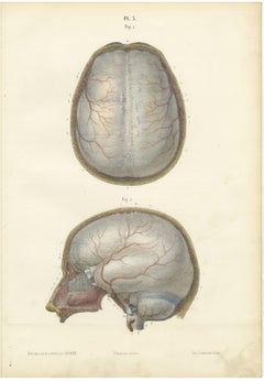 The Dura Mater of the Brain, Antique Hirschfeld Anatomy Print, 1866