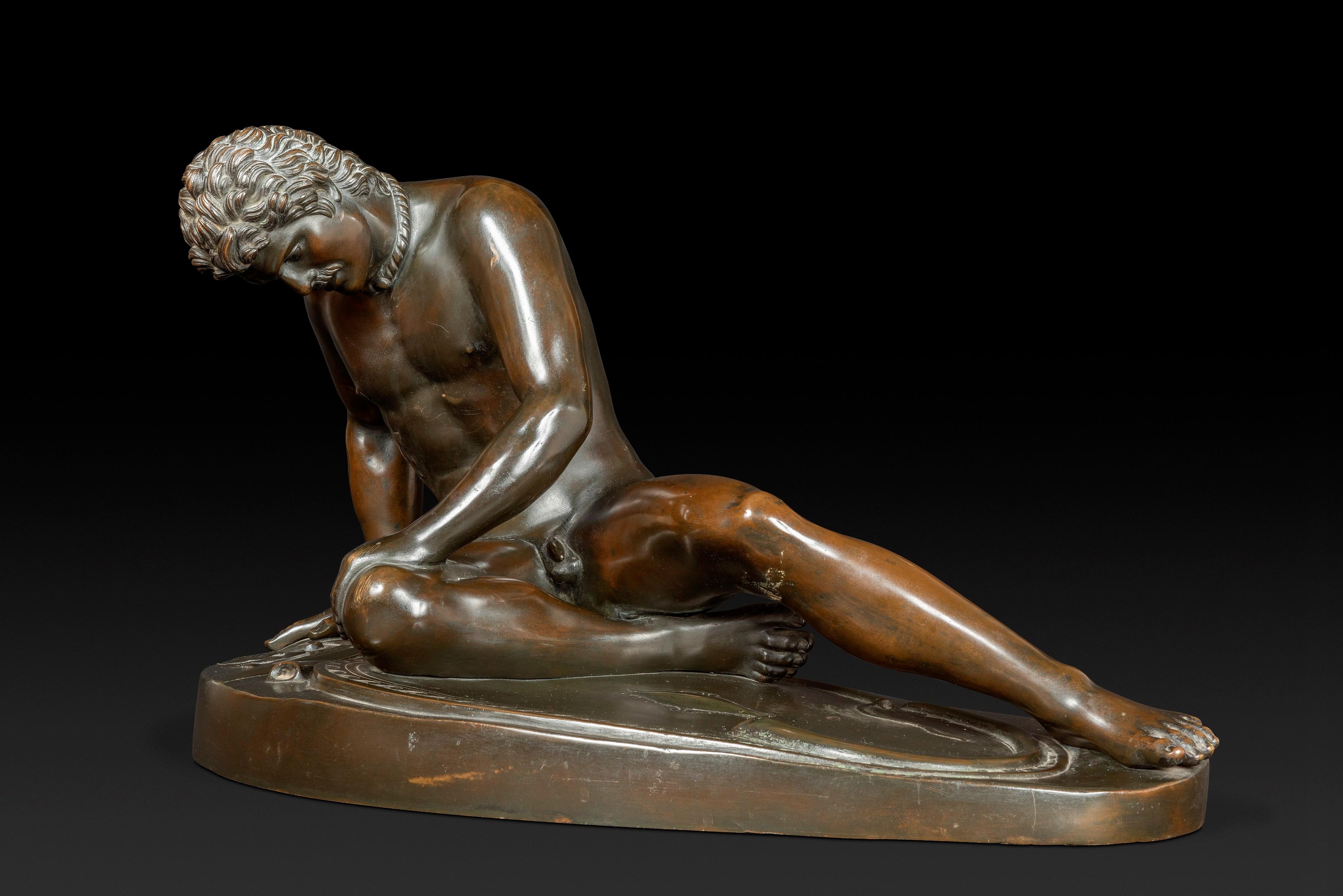 El Galo Moribundo.

- Descripción de la obra:

Un guerrero celta yace desnudo, medio recostado sobre su escudo, con el cuerpo contorsionado por el dolor. Su mano derecha toca el suelo mientras su rostro, marcado por el sufrimiento, está vuelto hacia