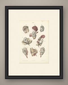 The External Ear, Antique Hirschfeld Anatomy Print, 1866