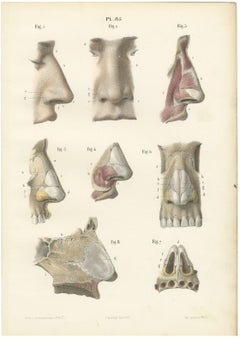 The External Nose and Its Cartilages, Antique Hirschfeld Anatomy Print, 1866