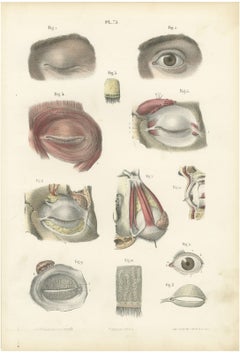 Die Augenlider und die Tränendrüse, antiker anatomischer Stich von Hirschfeld, 1866