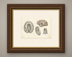 The Fornix and Choroid Plexus, Antique Hirschfeld Anatomy Print, 1866