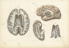The Fornix and Choroid Plexus, Antique Hirschfeld Anatomy Print, 1866