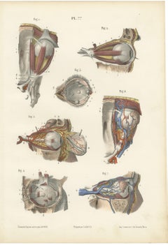 The Muscles of the Eyeball, Antique Hirschfeld Anatomy Print, 1866