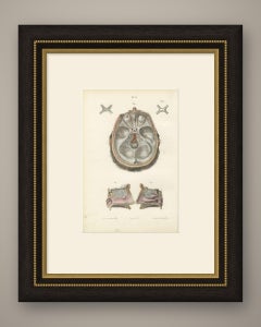 The Olfactory Nerves and Optic Chiasm, Antique Hirschfeld Anatomy Print, 1866