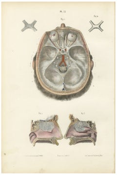 The Olfactory Nerves and Optic Chiasm, Antique Hirschfeld Anatomy Print, 1866