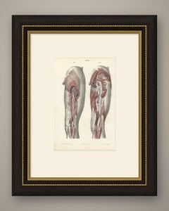 The Sciatic Nerve in the Thigh, Antique Hirschfeld Anatomy Print, 1866