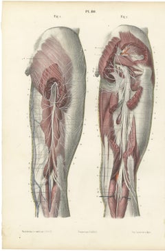 The Sciatic Nerve in the Thigh, Antique Hirschfeld Anatomy Print, 1866