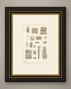 The Skin, Nail and Hair Follicle, Antique Hirschfeld Anatomy Print, 1866