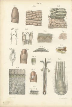 The Skin, Nail and Hair Follicle, Antique Hirschfeld Anatomy Print, 1866