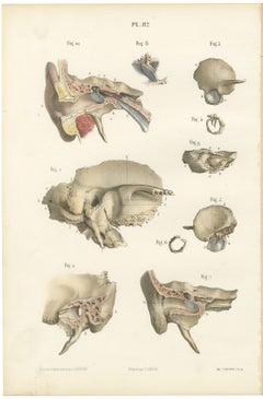 The Temporal Bone and Ear Canal, Antique Hirschfeld Anatomy Print, 1866