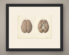 The Whole Brain from Above and Below, Antique Hirschfeld Anatomy Print, 1866
