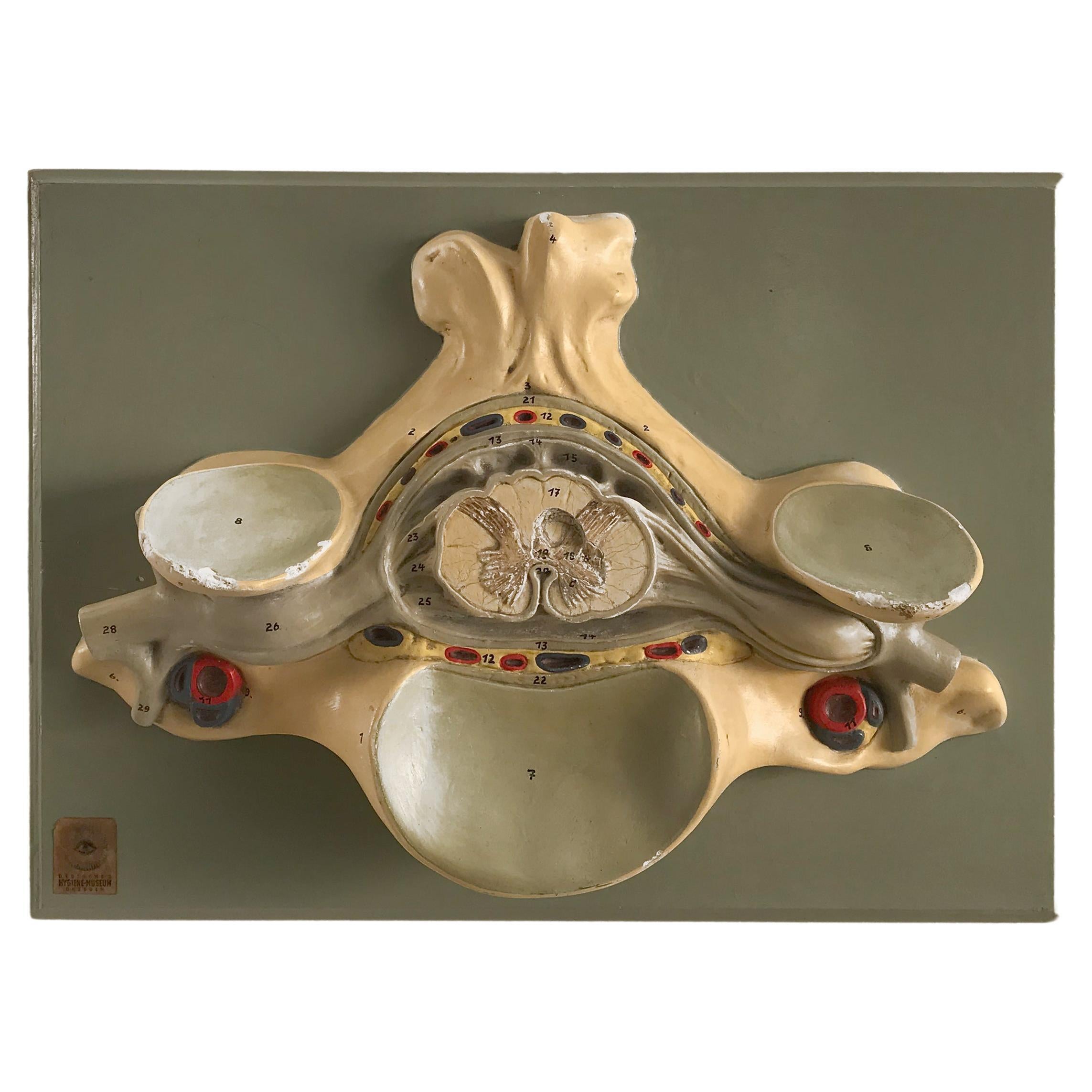 Three-Dimensional Midcentury Anatomical Wall Plaster Sculpture, Germany, 1950s For Sale