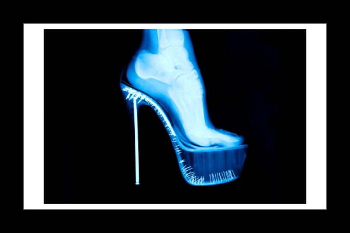 Tyler Shields - Chaussures à talons hauts avec rayons X, photographie 2012, imprimée d'après en vente 1