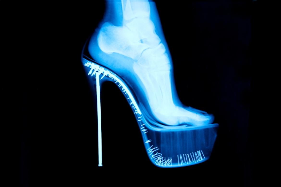 Tyler Shields - Chaussures à talons hauts avec rayons X, photographie 2012, imprimée d'après