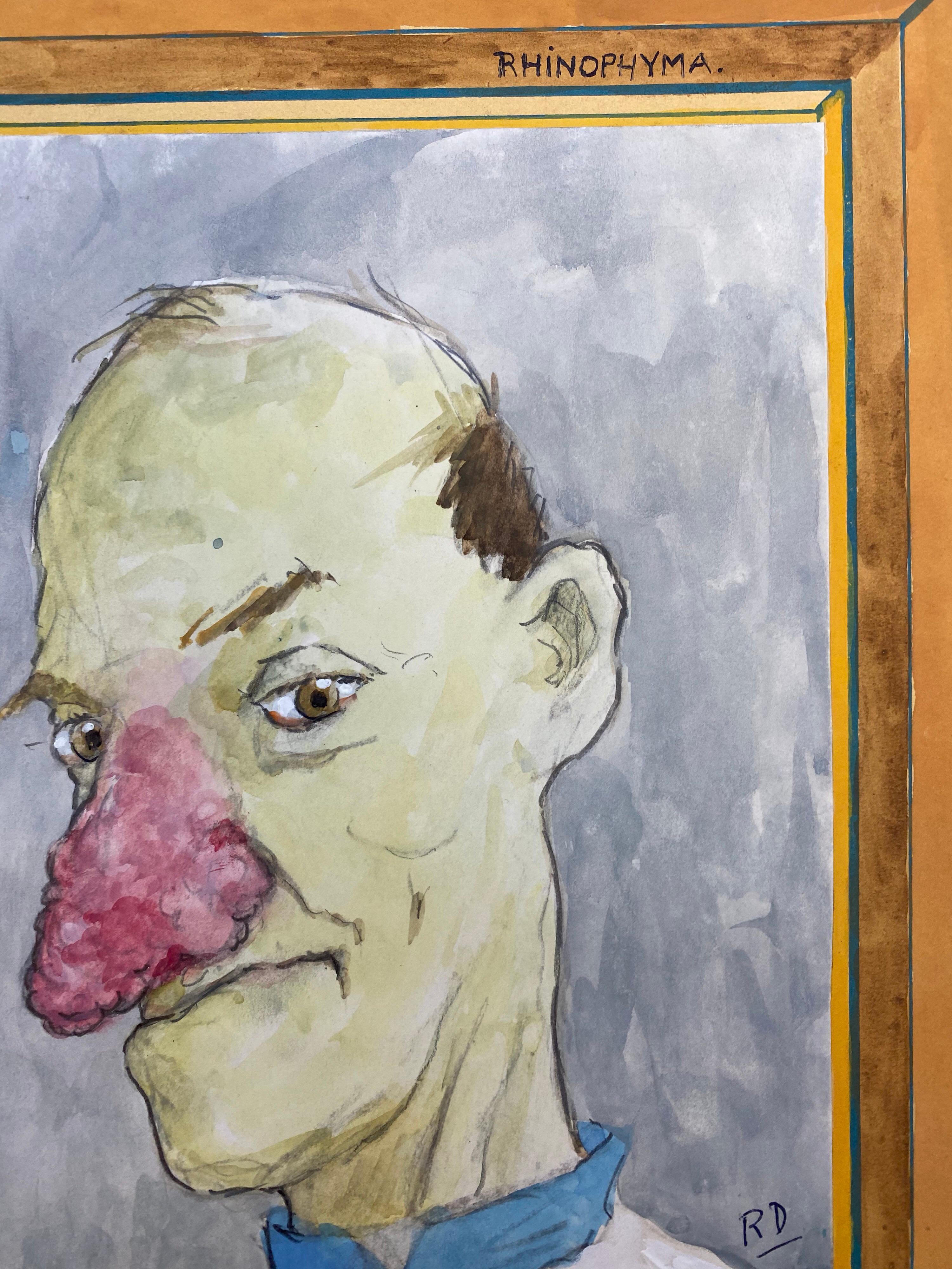 French Character Portrait
French school, Mid 20th Century
Gouache paint on unframed paper
signed lower corner
Image : 12.5 x 9.5 inches



Superbly decorative 1960's French portrait painting. Ideal for many interiors! So stylish and utterly