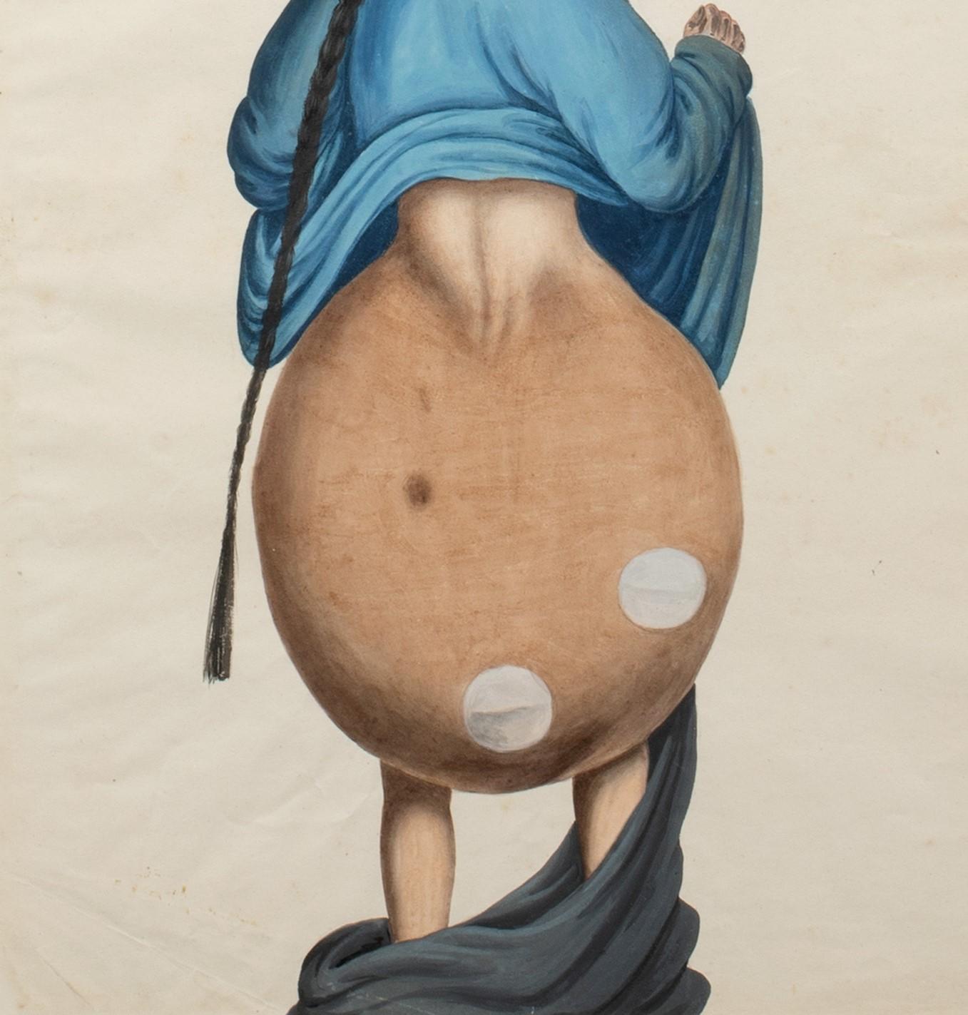 Medical Portrait Of A Chinese Cancer Patient, 19th Century  - Painting by Unknown