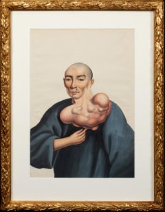 Medical Portrait Of A Chinese Cancer Patient, 19th Century 