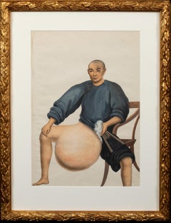 Medical Portrait Of A Chinese Cancer Patient, 19th Century 