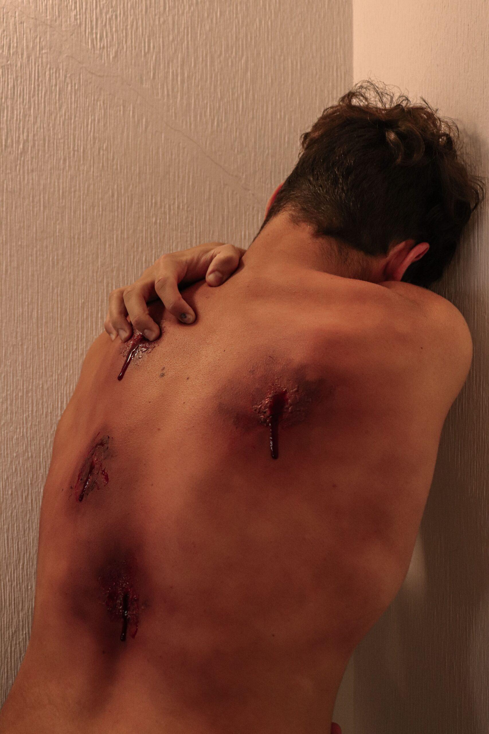 Heridas Abiertas - Photograph by Unknown