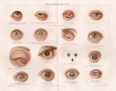 Enfermedades oculares, impresión cromolitográfica médica antigua alemana