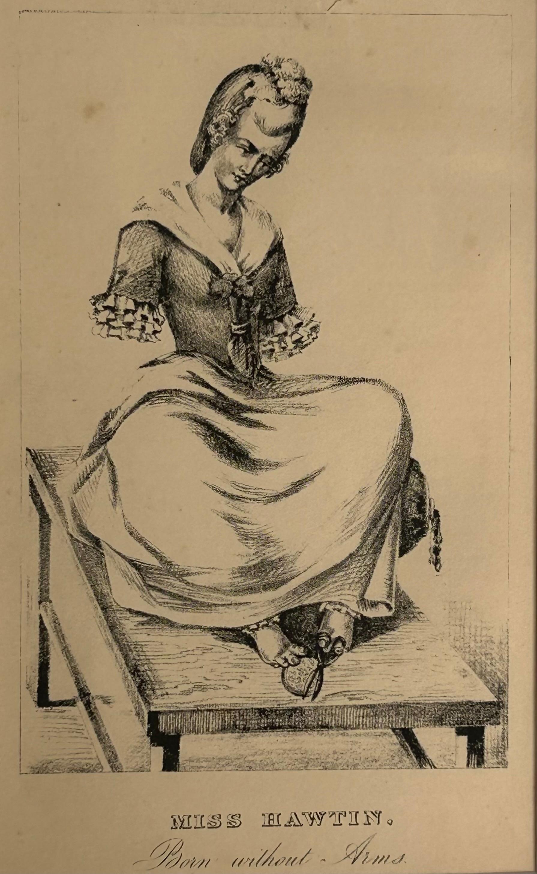Unknown Figurative Print - Miss Hawtin - Born without Arms