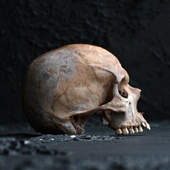 Unusual Gold Tooth 19th Century Natural History Specimen