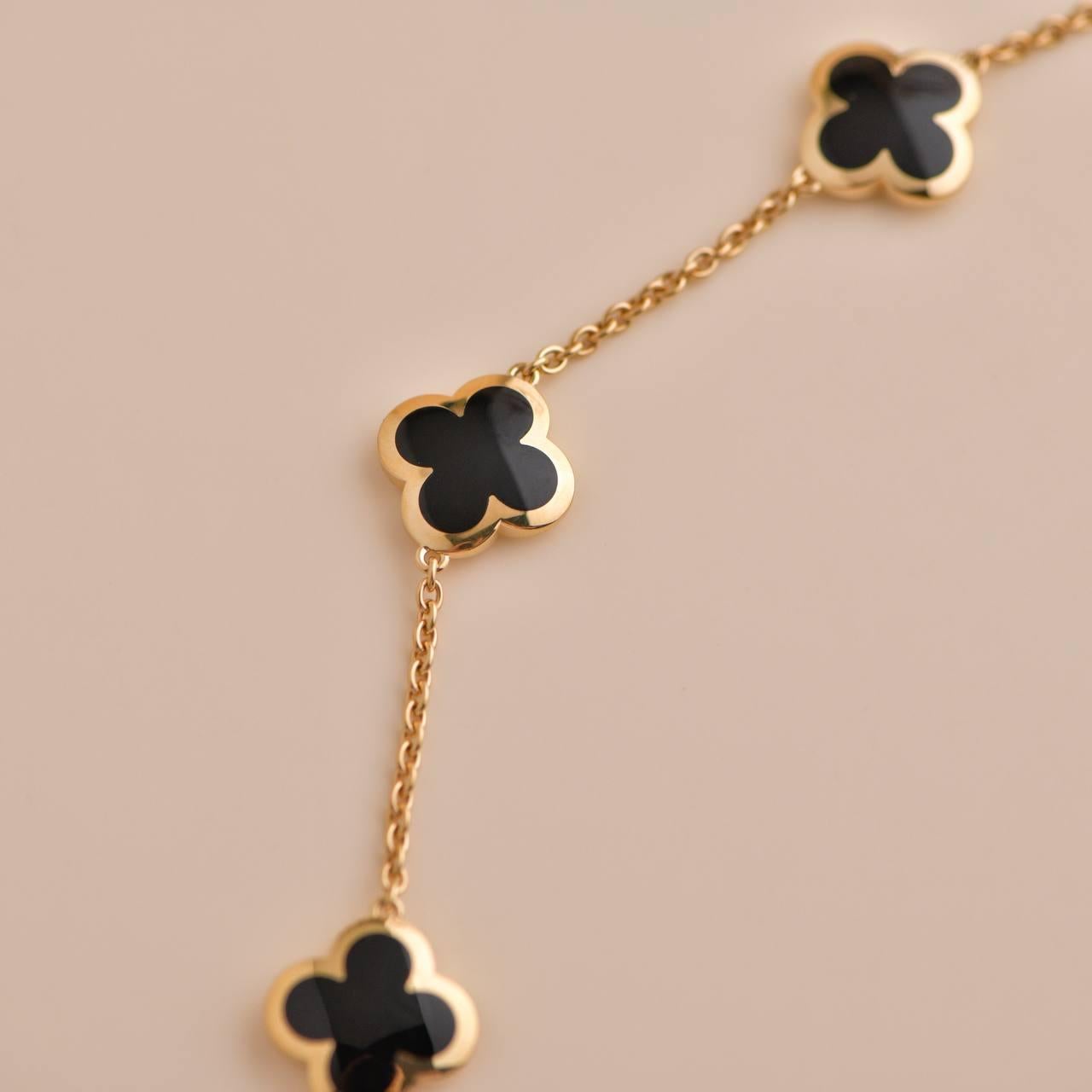 tenz bracelet