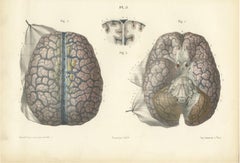 Veins of the Cerebral Hemispheres, Antique Hirschfeld Anatomy Print, 1866