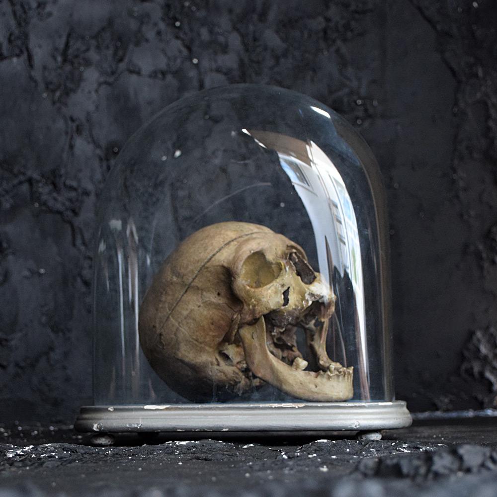 Victorian medical human skull in glass dome.

We share what we love, and we love the macabre look of this Victorian medical human skull in glass dome. With articulated jaw and encased in a Victorian hand-blown glass dome sat on a pine covered