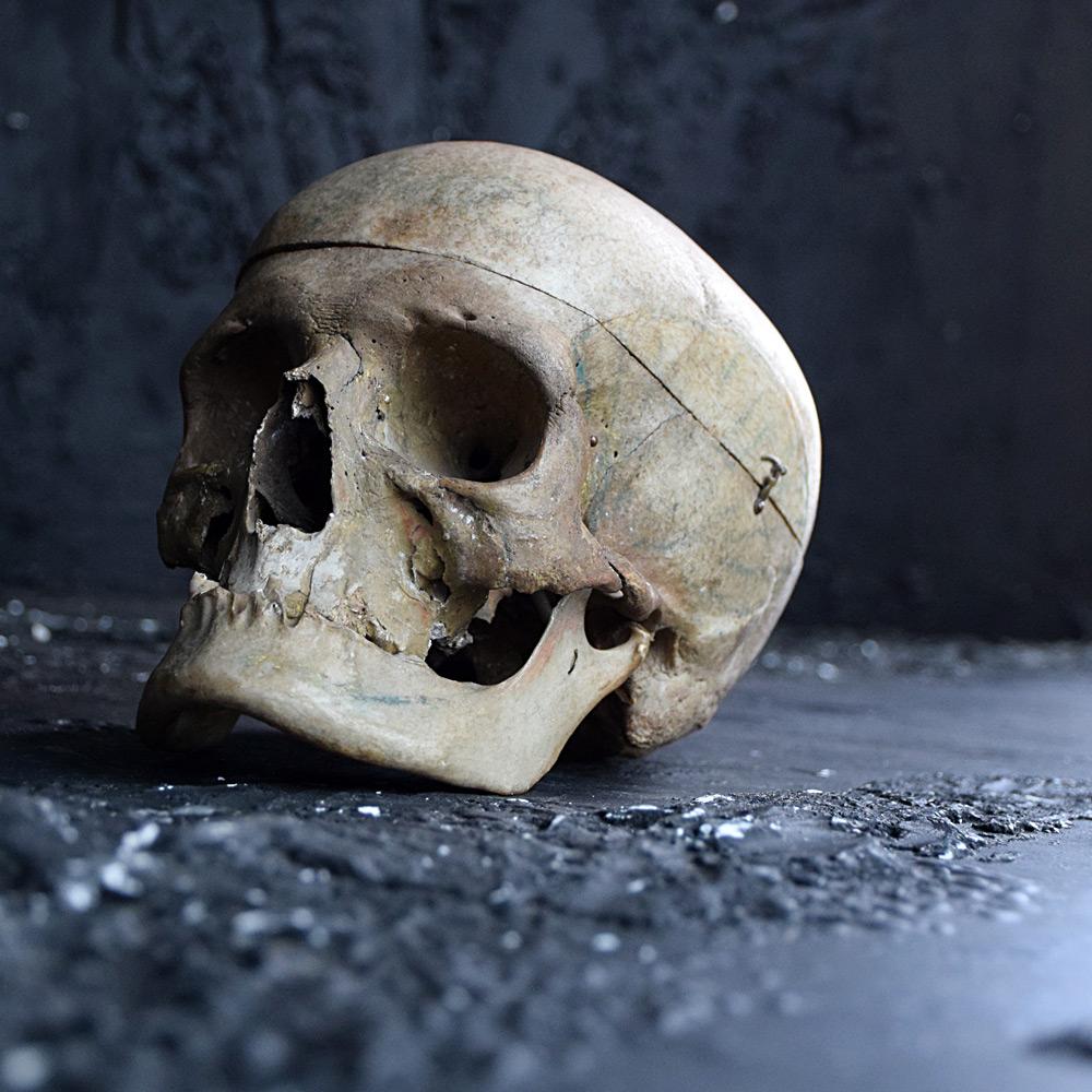 dome skull