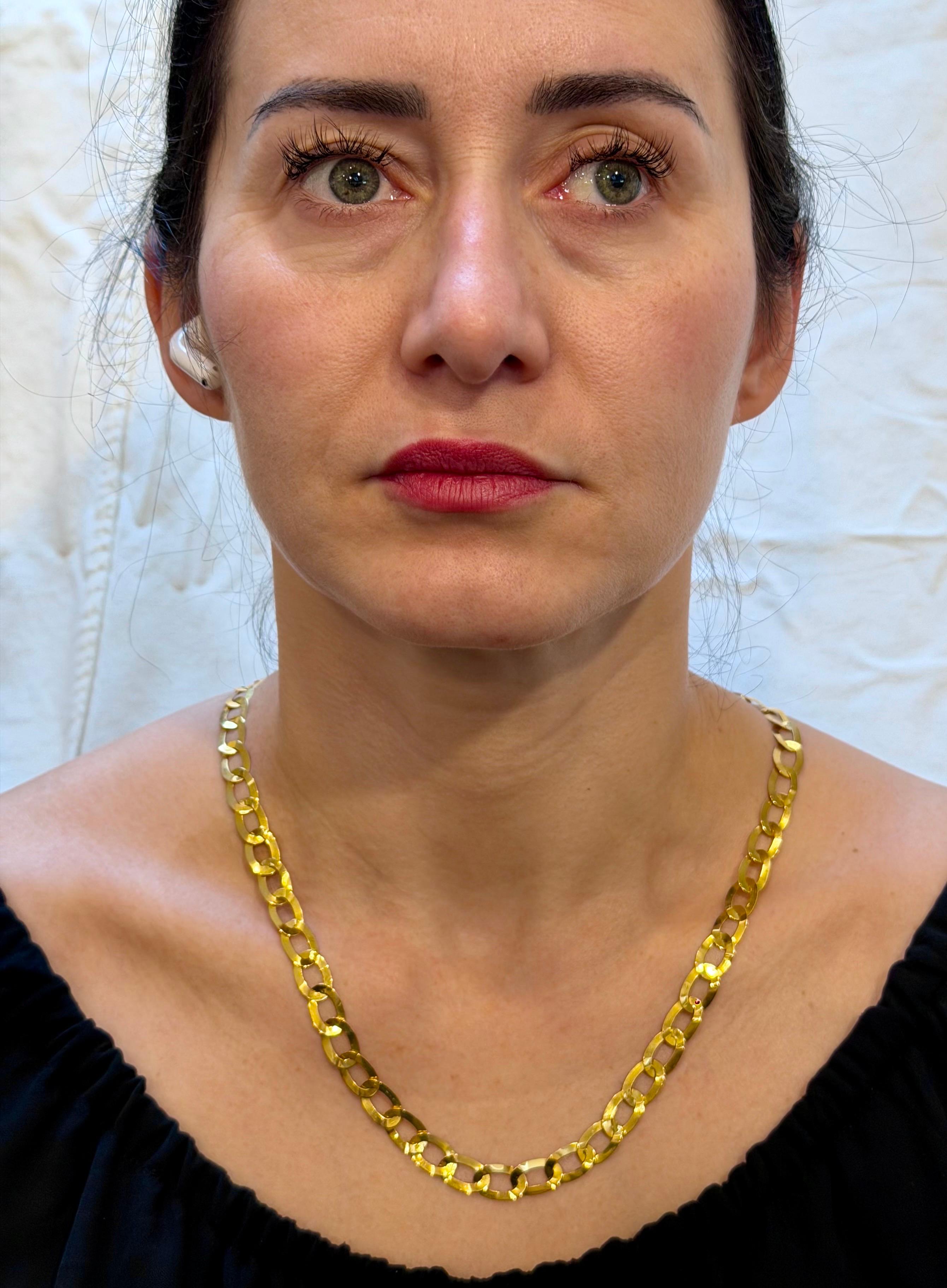 Vintage 18 Karat Yellow Gold 19.7 Gm Miami Cuban Link  Like Chain Unisex, 22