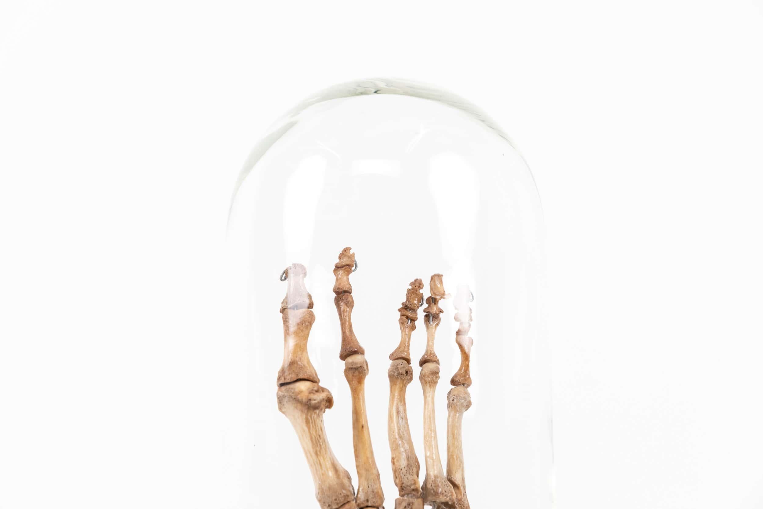 A scientific skeletal model of the human foot.

Decorative medical study of the bone make-up of the human foot, mounted to later base with glass dome.
