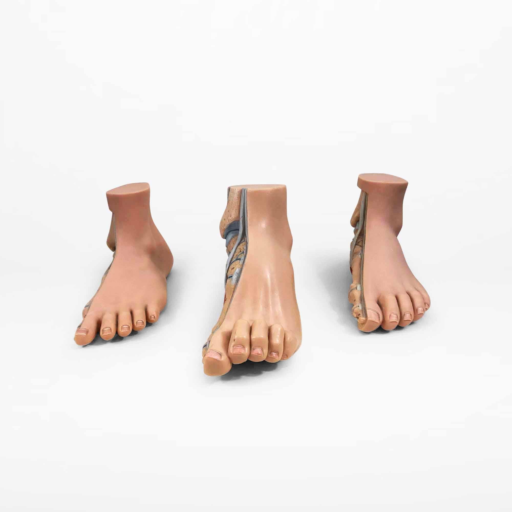 This set contains three anatomical models of human feet. These models show the most common foot conditions: flat foot, normal foot, and a high arch. This classic medical model is very detailed and has beautiful colors. It was designed to teach