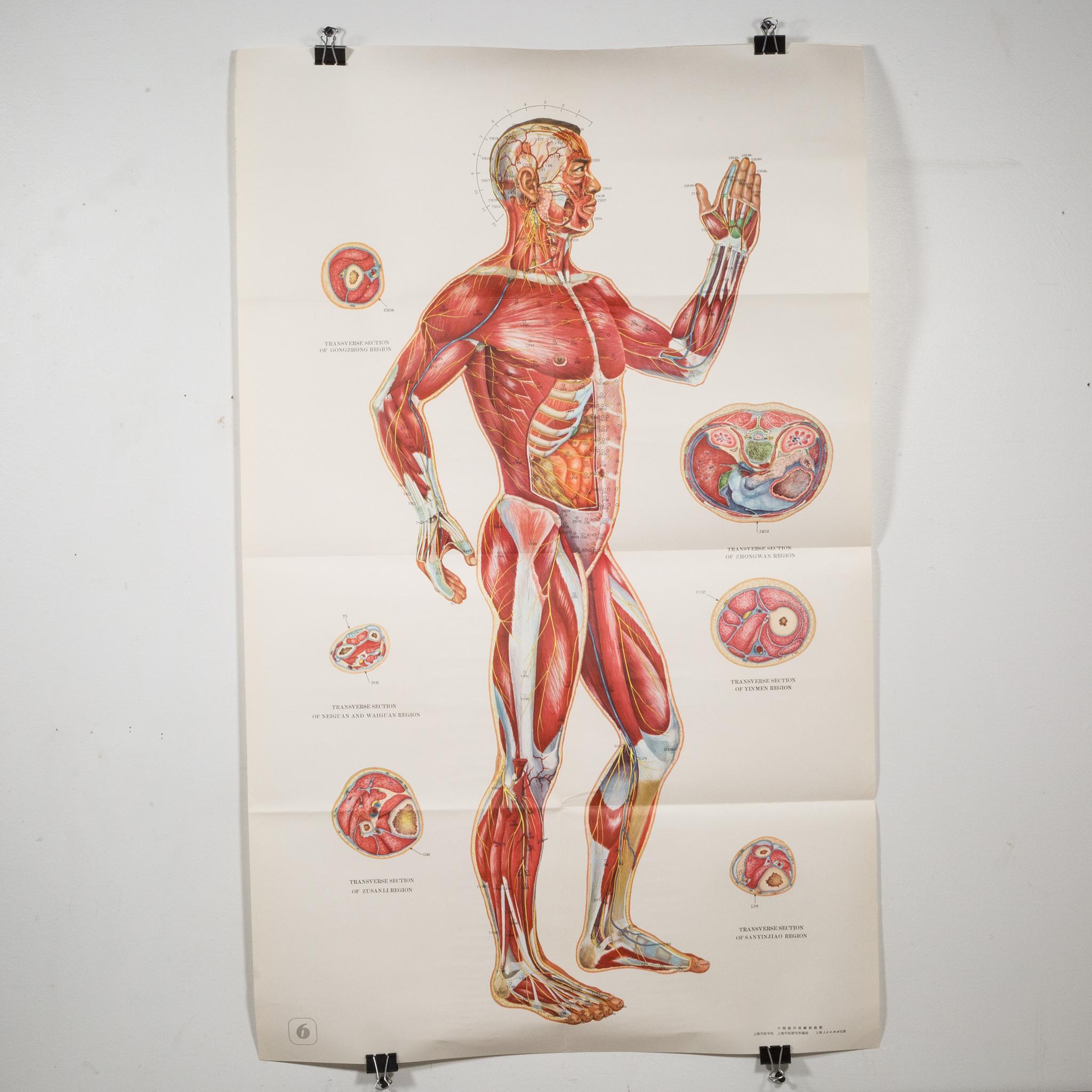 Vintage Chinese Acupuncture Posters c.1976 2
