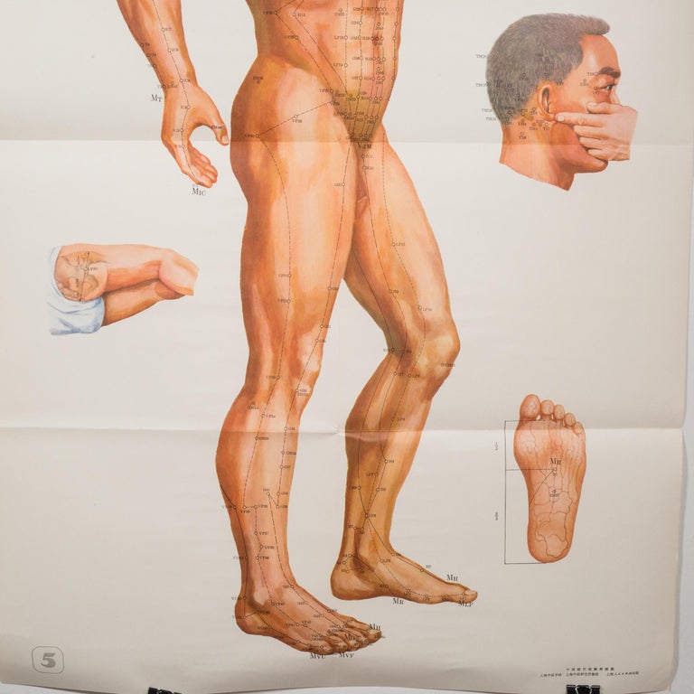 Vintage Chinese Acupuncture Posters c.1976 10