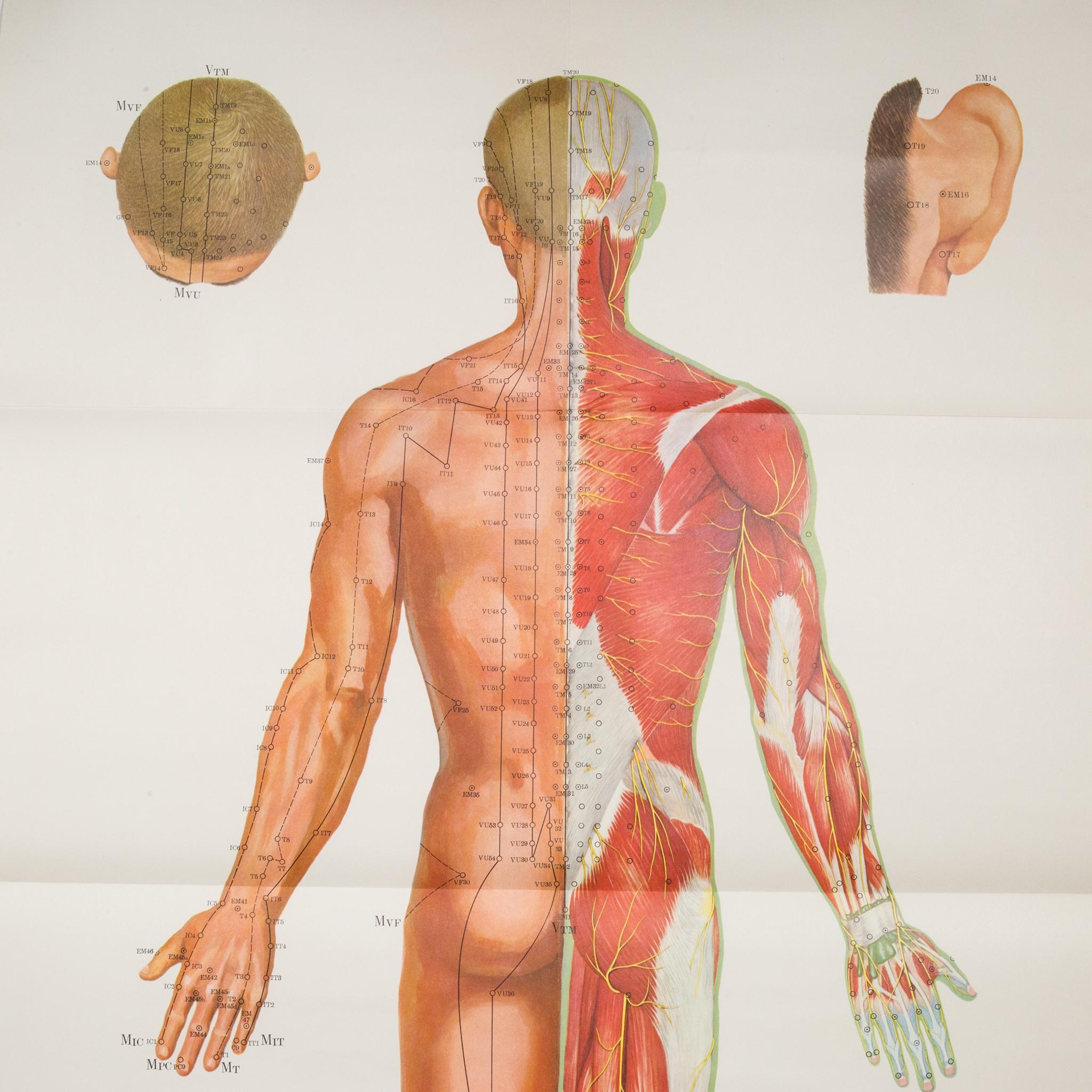 Vintage Chinese Acupuncture Posters c.1976 1