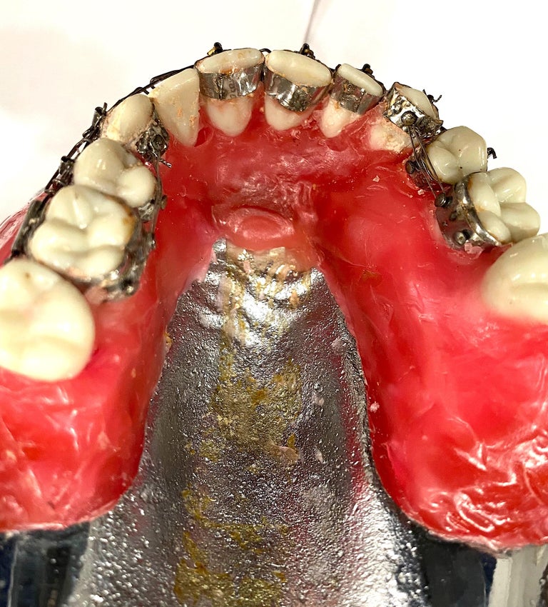 Vintage Dental Model of Mouth with Braces in Original Box by Columbia