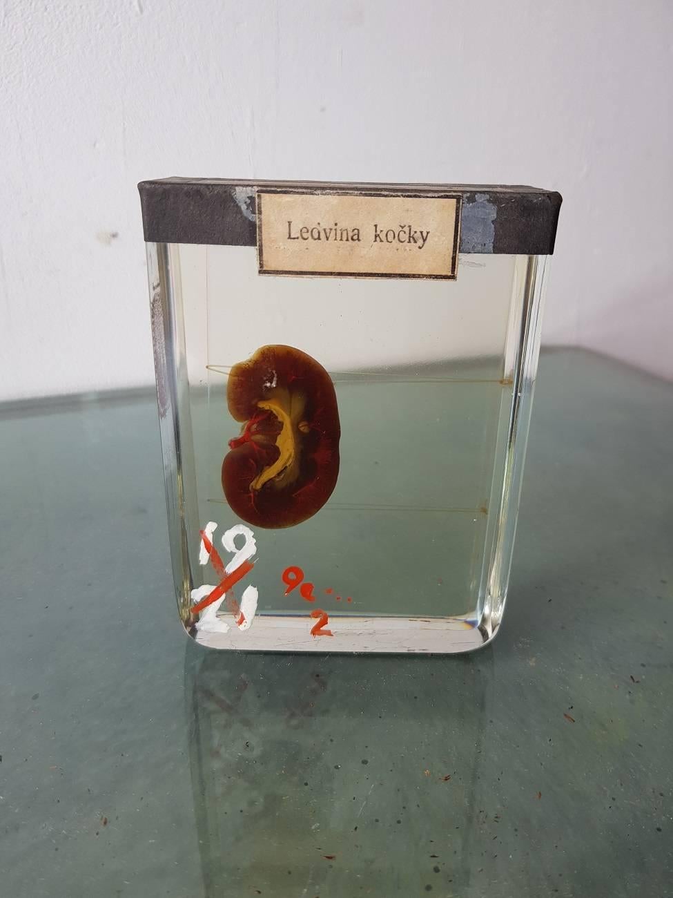 Vintage in strong water cats kidney from Eastern Europe, mid-20th century.

The measurements are,
Depth 3 cm/ 1.1 inch.
Width 8 cm/ 3.1 inch.
Height 10.5 cm/ 4.1 inch.
 