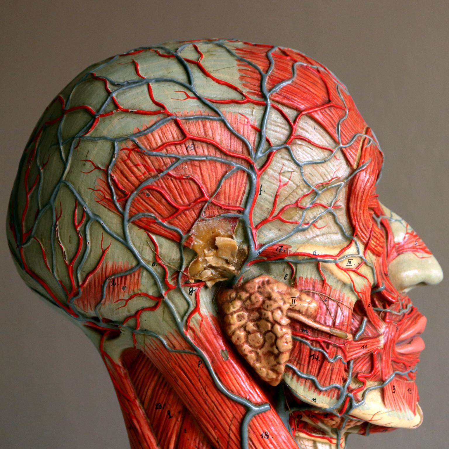 European Vintage Medical Half Head Painted Anatomical Model, 1950s