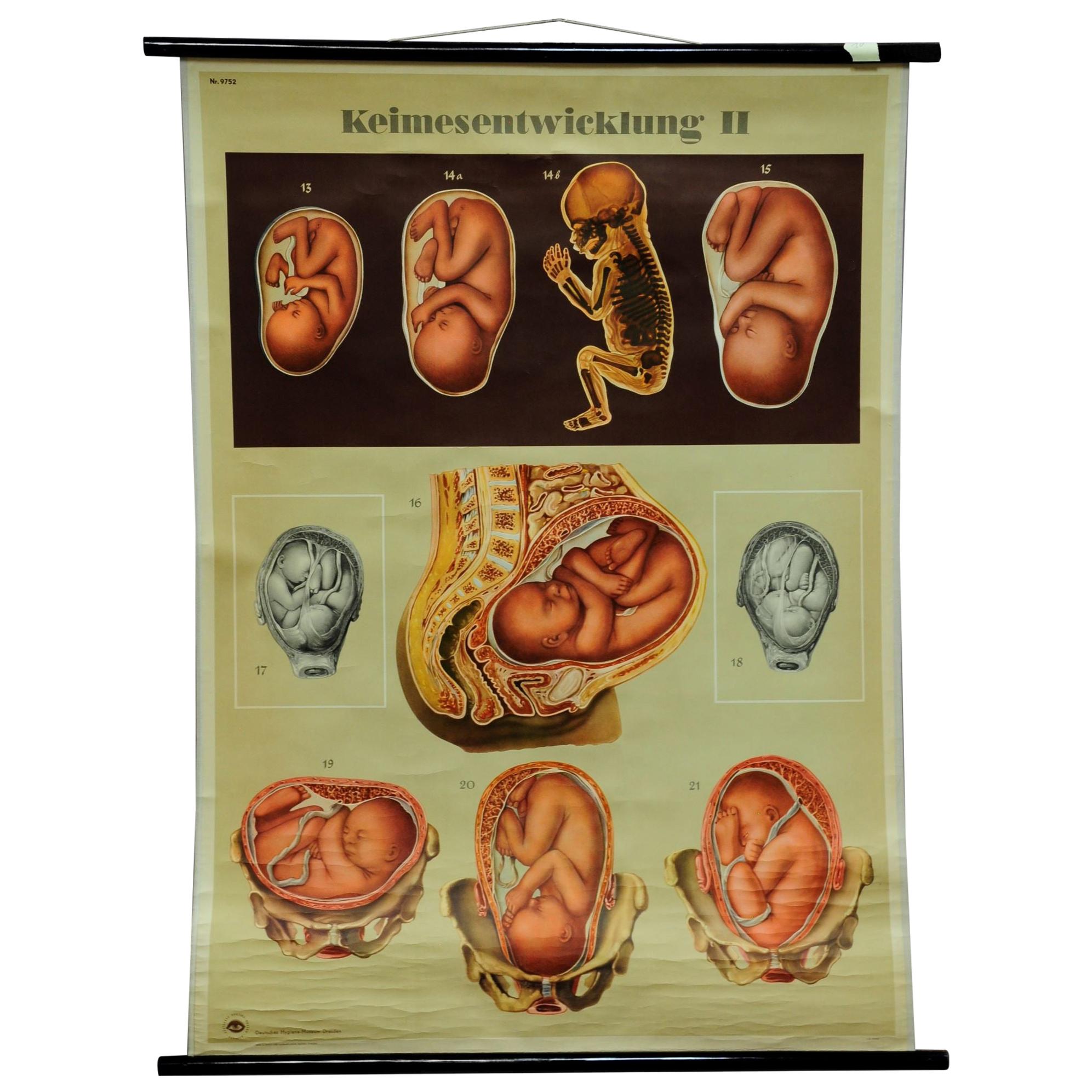 Vintage Medical Poster Pull Down Wall Chart about Ontogeny