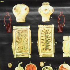 Vintage Medical Pull Down Wall Chart about the Tapeworm Parasite