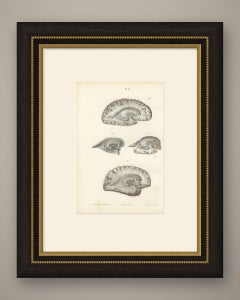 White Matter of the Cerebral Hemisphere, Antique Hirschfeld Anatomy Print, 1866