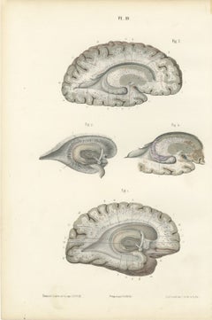 White Matter of the Cerebral Hemisphere, Antique Hirschfeld Anatomy Print, 1866