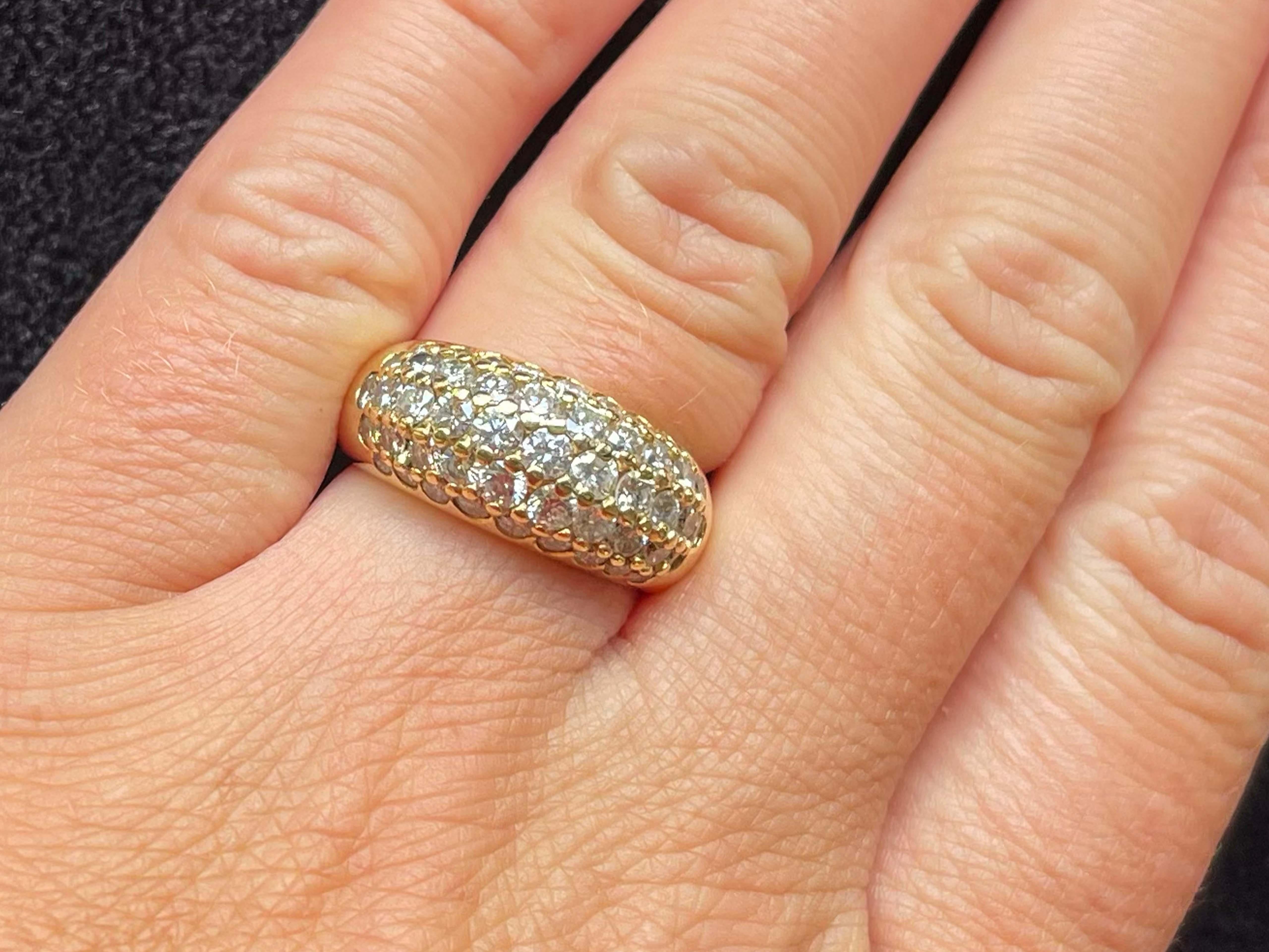 Artikel-Spezifikationen:

Metall: 18K Gelbgold

Stil: Statement-Ring

Ringgröße: 6.5 (Größenänderung gegen Gebühr möglich)

Gesamtgewicht: 8,5 Gramm

Diamant Karat Gewicht: 1.50

Diamant-Farbe: G-I

Diamant Reinheit: SI1-SI2

Zustand: Gebraucht,
