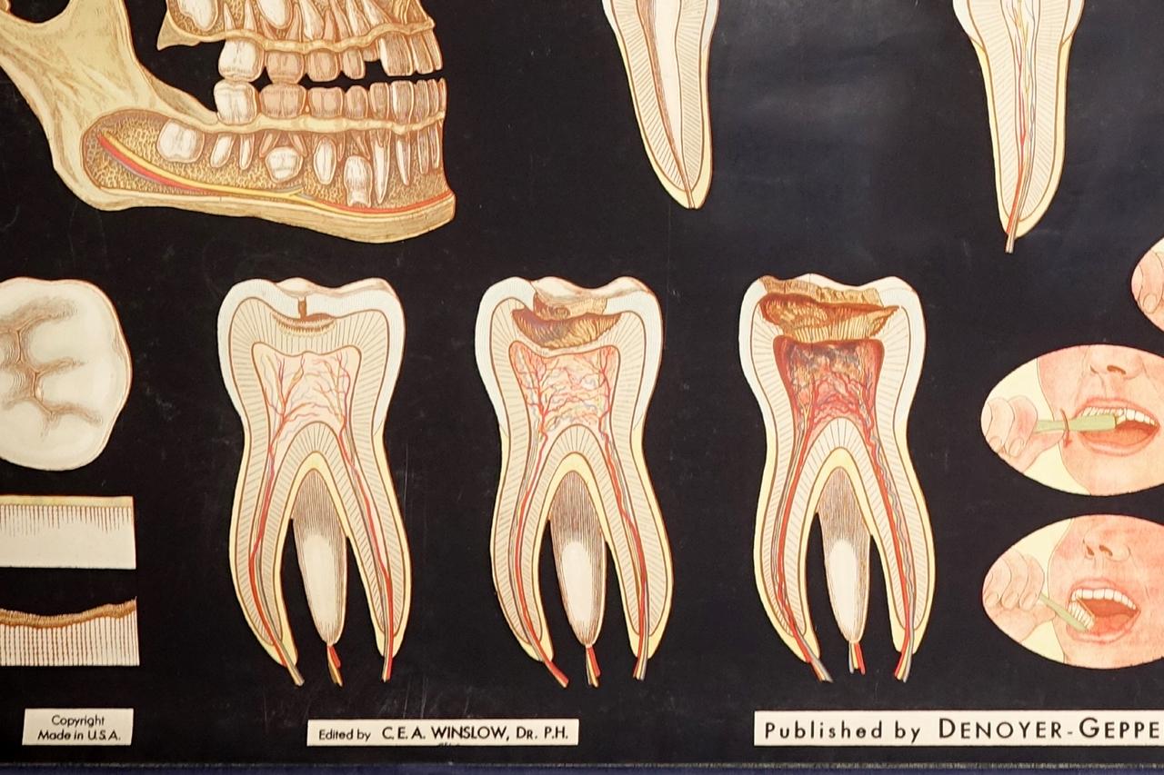 dental hygiene posters