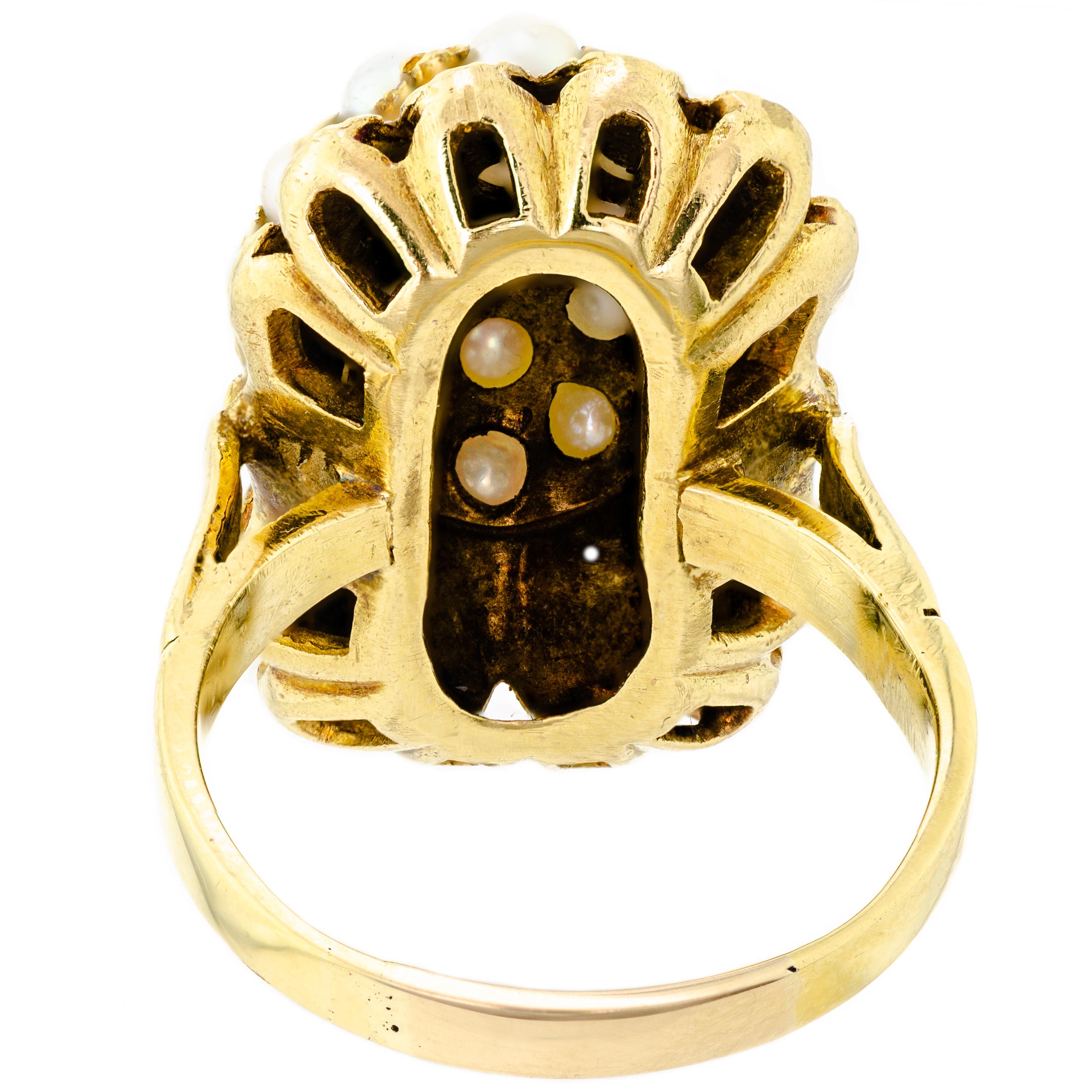 Taille ronde Merveilleuse Retro Circa 1945 Dome Bombe Style Cultured Pearl and 14Kt Yellow Gold  en vente